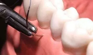 korkud kapak e1691133119107